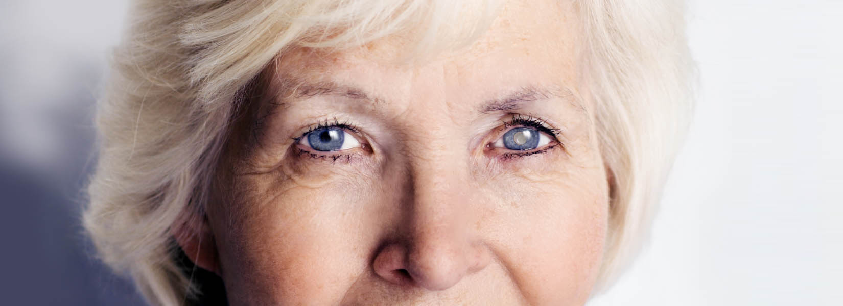 Cataract Surgery in Ashtabula